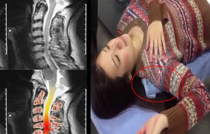 Bác sĩ Nhật hướng dẫn bài tập 2 phút giúp giảm đau nhức vùng cổ vai gáy ngay lập tức