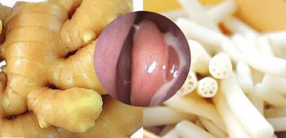 Gừng + Ngó sen bài thuốc nạo vét sạch mủ do viêm xoang chỉ trong vài lần sử dụng
