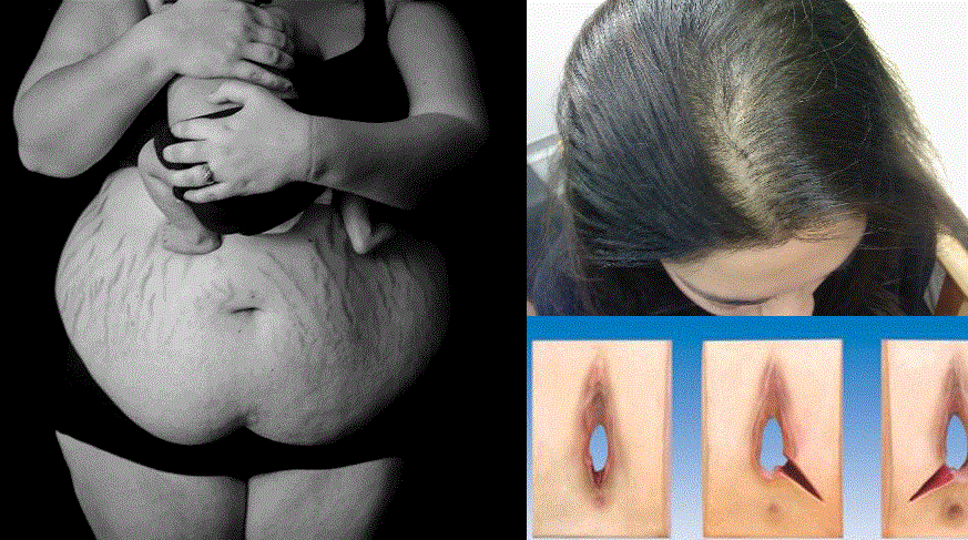 11 Chỗ Của Mẹ Bị THIỆT HẠI TRẦM TRỌNG Sau Khi Sinh Con, Vì Con Mẹ Hi Sinh Quá Nhiều, Bố Có Thấy Xót Không?