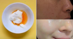 Da quá đen muốn trắng cấp tốc mà sợ tiêm kích trắng, trộn ngay 3 thứ này, thoa đến đâu da trắng bật tông đến đó khiến ai cũng kinh ngạc