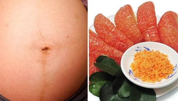 Bà bầu ăn bưởi theo cách này canxi hấp thu trọn vẹn, chẳng còn lo thiếu máu