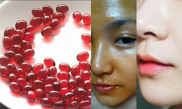 Bõ công thoa 2 viên này lên mặt, da em không những trắng mà mụn, sẹo thâm, nám cũng vĩnh viễn ra đi mà chẳng cần uống collagen