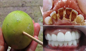 Nhai thứ này 2 phút trước khi ngủ, cao răng tróc ra từng mảng, hôi miệng kinh niên cũng chào thua