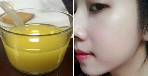 Dùng nước nghệ theo cách này, da có mụn cỡ nào cũng sạch ban