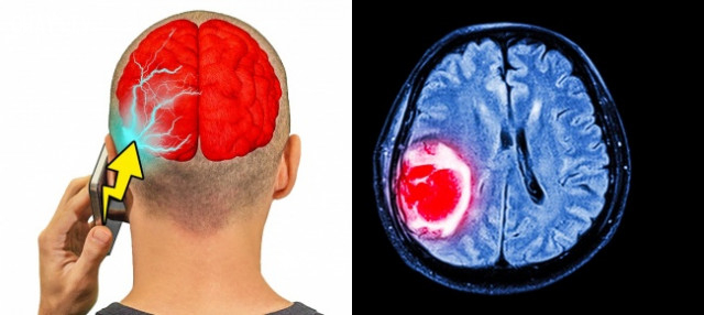 Ngủ quá gần thứ này, sớm muộn gì bạn sẽ không MẤT TRÍ NHỚ thì cũng VÔ SINH