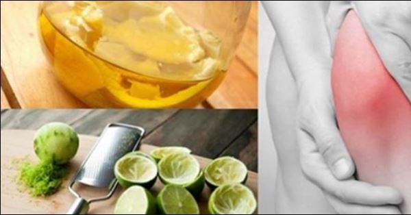 Bôi thứ này lên chỗ đau – Đau khớp đến đâu cũng biến mất sau vài lần sử dụng