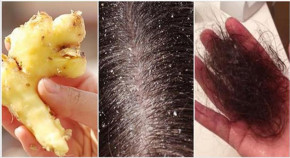 Giã 1 củ gừng rồi gội đầu theo cách này, gàu trắng xóa, tóc rụng như mưa cũng bóng mượt trở lại