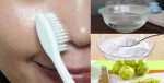 Công thức trị mụn đầu đen, mụn cám không thể bỏ qua
