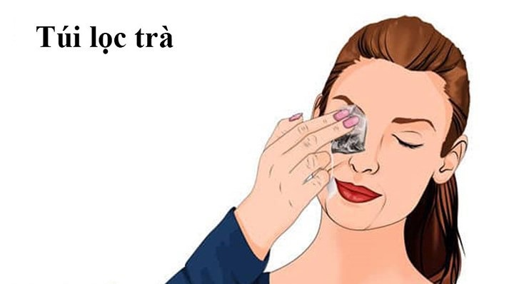 Mắt sưng húp vì mất ngủ cả đêm, hãy áp dụng ngay những biện pháp này