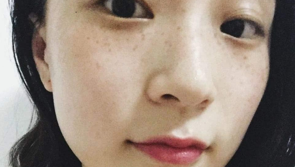 Trị “GIẶC” Nám Bằng Phương Pháp Hiệu Quả Được Phái Đẹp Cả Nước Tin Dùng