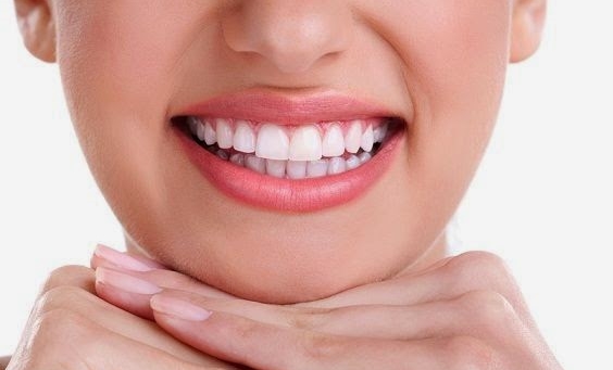 Sau Khi Tẩy Trắng Răng Cần Làm Gì?