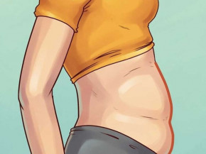 Béo bụng cũng có rất nhiều loại và đây là giải pháp cho từng trường hợp