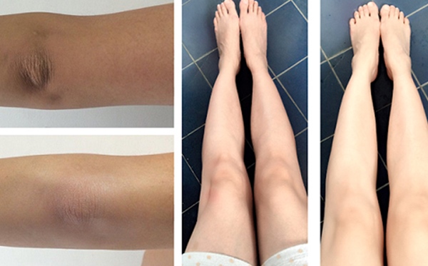 Nách, khuỷu tay, đầu gối thâm đen xì cũng được tẩy trắng không tì vết nhờ chanh và kem đánh răng