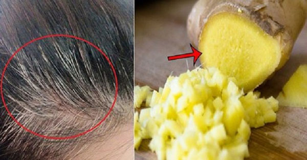 Tóc bạc sớm dù nặng đến mấy cũng đen nhánh trở lại tức thì với 2 nhánh tỏi và 1 củ gừng