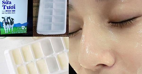 Đông đá sữa tươi đem thoa lên mặt, giật mình vì mụn thâm hết sạch, da bật hẳn 3 tông