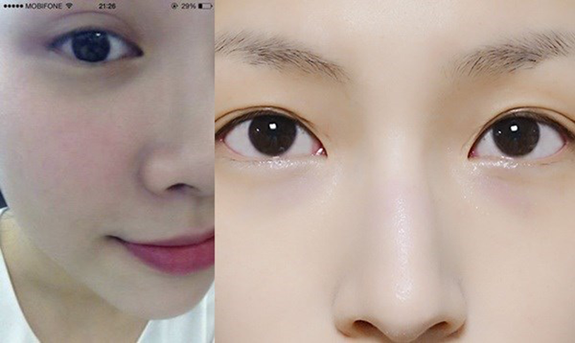 Trộn bột sắn dây với trứng gà để đắp mặt, da trắng mịn sau vài lần