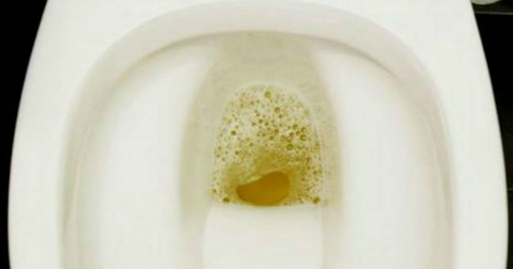 Những dấu hiệu khi đi tiểu cho biết bạn đã mắc bệnh thận rất nặng mà bạn không hề hay biết