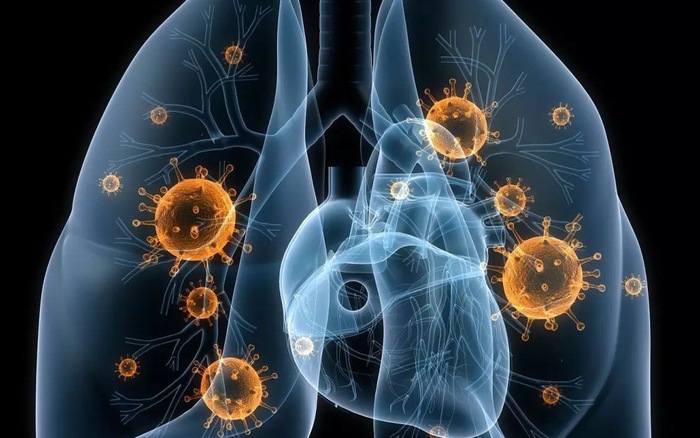 7 cách phòng ngừa bệnh ung thư phổi từ sớm mà ai cũng nên biết và chia sẻ người thân yêu bên cạnh biết để phòng bệnh