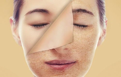 Bí Kíp Chống Lão Hóa Dành Cho Chị Em Nên Tham Khảo