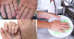 4 Tuyệt chiêu giúp tìm lại đôi tay mềm mịn như em bé sau những lần da khô ráp vì rửa chén