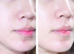 Quy trình trị mụn 10 bước của gái Hàn chỉ sau 10 ngày da láng mịn lại còn trắng lên!