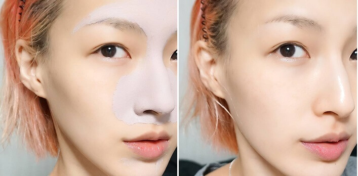 Trọn bộ 5 công thức trị mụn, giảm thâm cho bạn làn da sáng mịn, đều màu