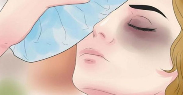 Loại bỏ vết thâm quầng mắt bằng 5 mẹo vặt cực hay này