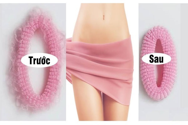 Chìa khóa giúp bạn có một vùng kín săn chắc, se khít, hồng hào và tự tin hơn trong chuyện vợ chồng