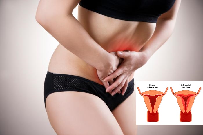 Bài thuốc chữa dứt rong kinh kéo dài 1 năm chỉ sau 1 lần uống