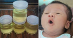 Cách dùng dầu dừa chữa 20 bệnh cho trẻ nhỏ mẹ nào cũng nên thủ sẵn cho con