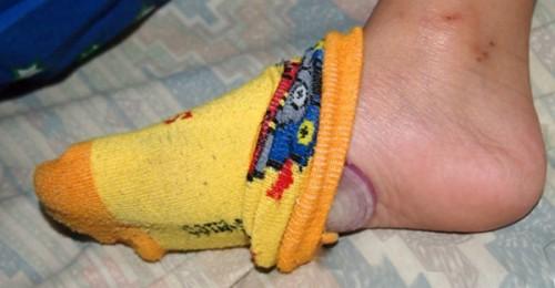 Khi nào bị cúm, chỉ cần dùng mẹo đơn giản này là sẽ khỏi ngay CHỈ TRONG 1 ĐÊM