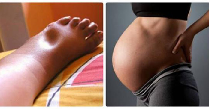 Không chỉ cơn đau đẻ, mẹ còn gánh chịu 5 cơn đau kinh khủng này khi mang thai