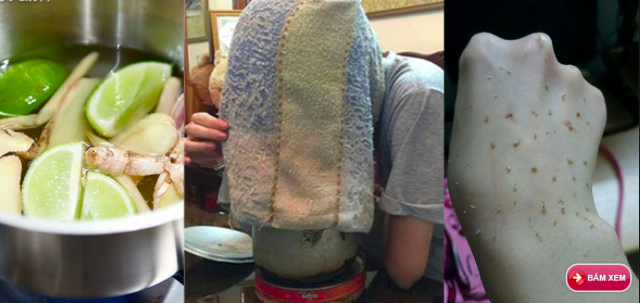 Tết đến rồi, hãy dùng chanh sả xông mặt để lột sạch mụn ẩn, trắng hồn tự nhiên nhé