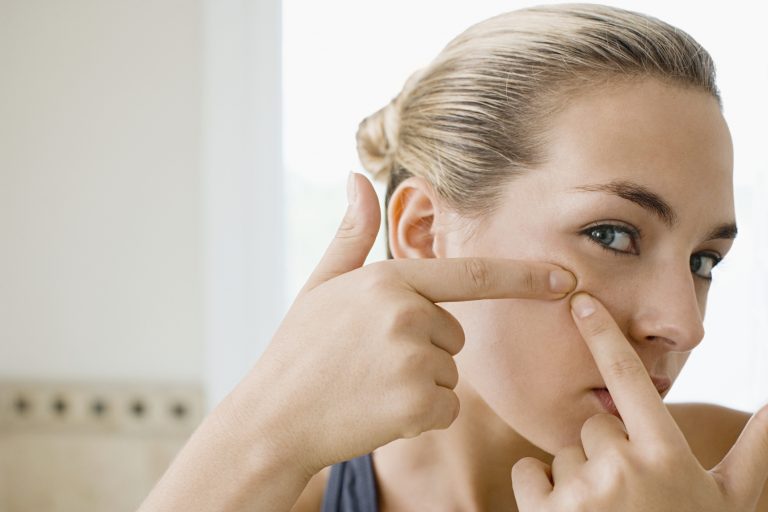 Truy tìm nguyên nhân gây mụn ẩn và cách điều trị hiệu quả
