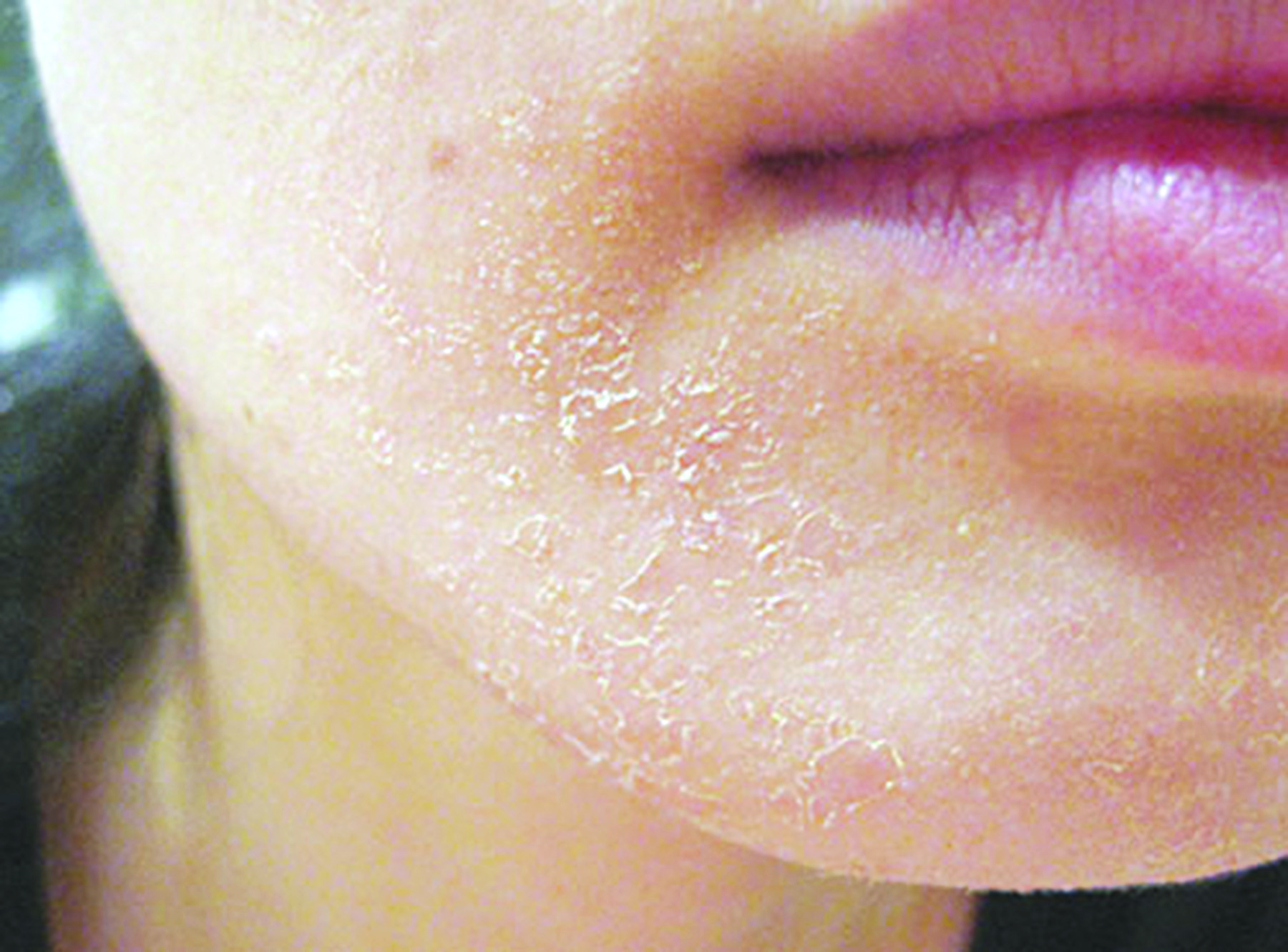 Đề phòng dị ứng mỹ phẩm