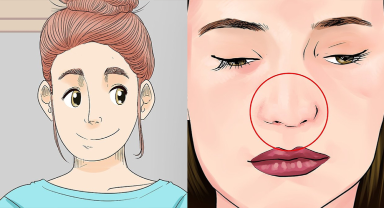 ‘Trán sân bay’ là nét tướng bị cho rằng xấu xí nhưng là dấu hiệu đại phú đại quý