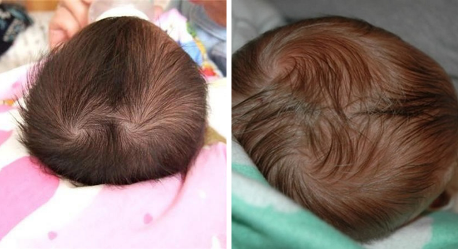 Người Có 2 Xoáy Tóc: Thông Minh, Mang Số Giàu Có, Đào Hoa