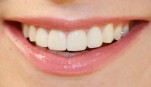 Nhìn răng đoán bệnh và tính cách của bạn