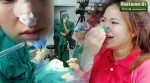 Thiếu nữ liều lĩnh tự dùng kẹp quần áo làm gọn mũi