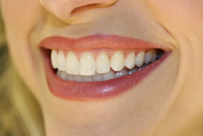 Ăn gì để cải thiện màu răng đã ố vàng?