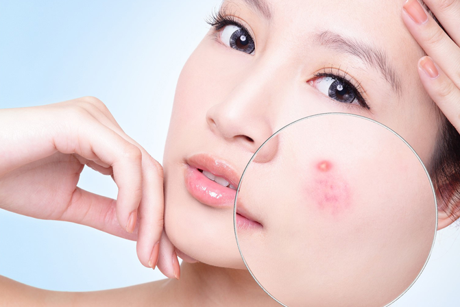 Da nhạy cảm và những lưu ý vàng khi chăm sóc da