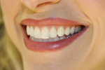 Ăn gì để cải thiện màu răng đã ố vàng?