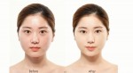 Cách trang điểm như gái Hàn cho làn da dầu, mụn