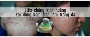 Biến chứng kinh hoàng từ các loại kem trộn làm trắng da