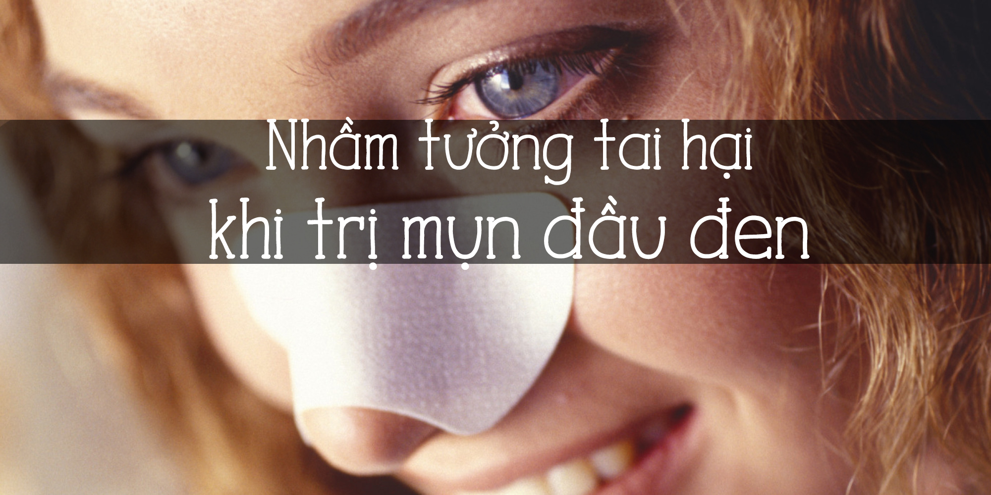 Sai lầm khi trị mụn đầu đen ai cũng có thể nhầm