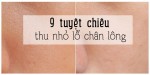 9 cách thu nhỏ lỗ chân lông tự nhiên tại nhà