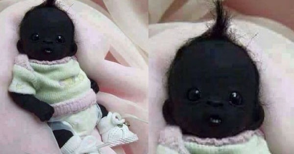 "Em bé đen nhất thế giới" tạo sóng lớn trên các mạng xã hội