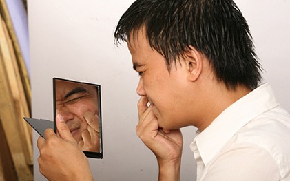Nhật ký 12 ngày trị mụn cho tuổi dậy thì