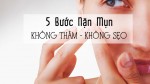 5 bước nặn mụn an toàn không để lại thâm và sẹo
