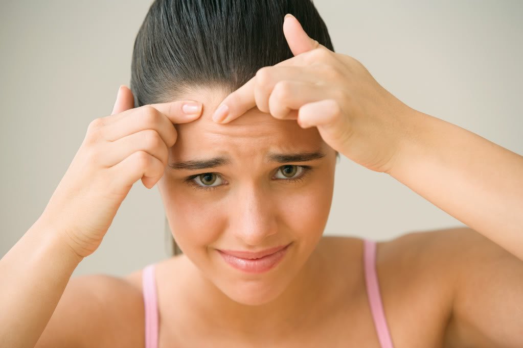 Cách nặn mụn giúp liền mụn hiệu quả